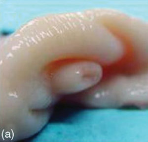 Sheep Artificial Insemination